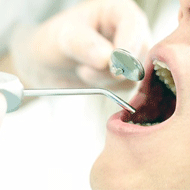 訪問歯科の利用条件